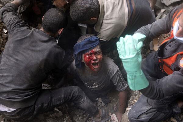 An injured Palestinian boy cries as rescuers try to pull him out of the rubble of a destroyed building following an Israeli airstrike in Bureij refugee camp, Gaza Strip. File picture: AP Photo/Mohammed Dahman An injured Palestinian boy cries as rescuers try to pull him out of the rubble of a destroyed building following an Israeli airstrike in Bureij refugee camp, Gaza Strip. File picture: AP Photo/Mohammed Dahman